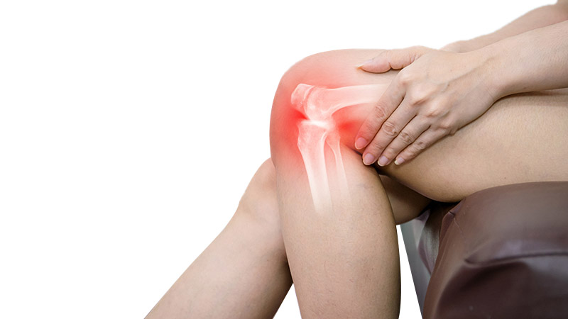 Osteoarthritis of the knee joint