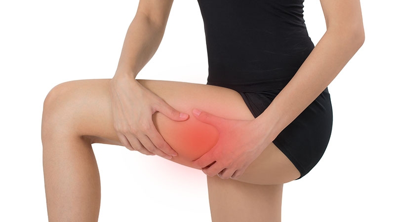 Trochanteric bursitis – lateral hip pain